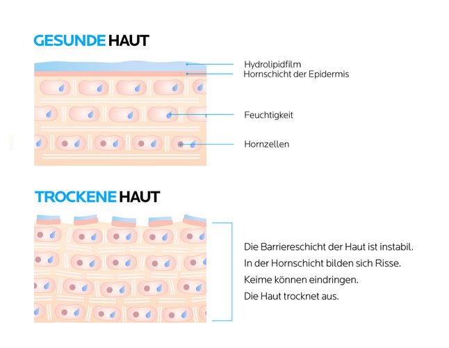 Aufbau der Haut: Hautschutzbarriere bewahrt die Haut vor dem Austrocknen