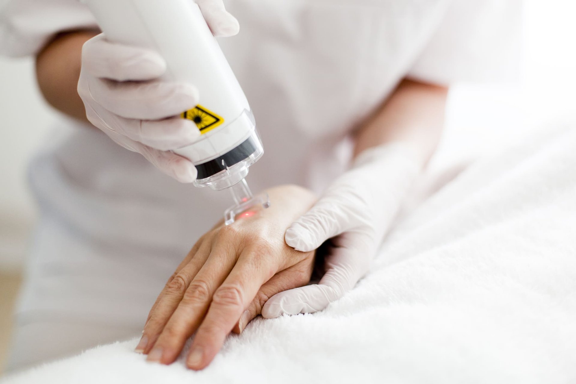 Laserbehandlung an der Hand